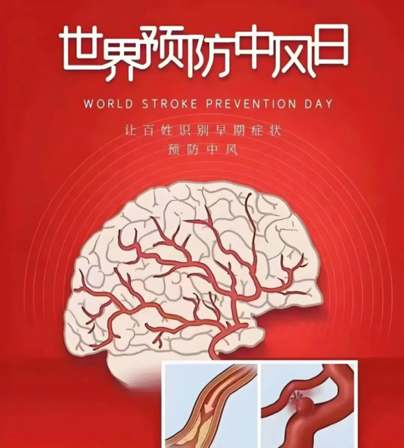 警惕“中风”突袭!脑卒中全面科普