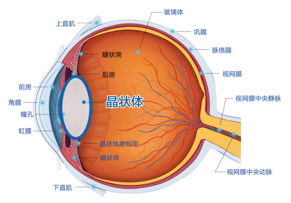 ​眼睛比皮肤更怕“晒”，紫外线加速白内障形成